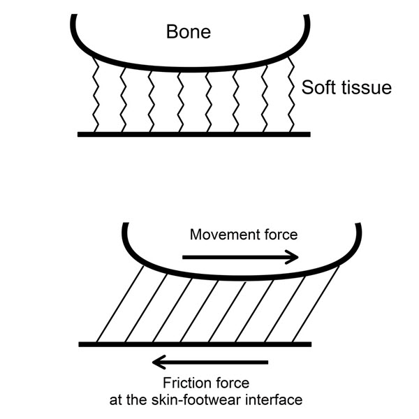 simple shear diagram helps explain blisters